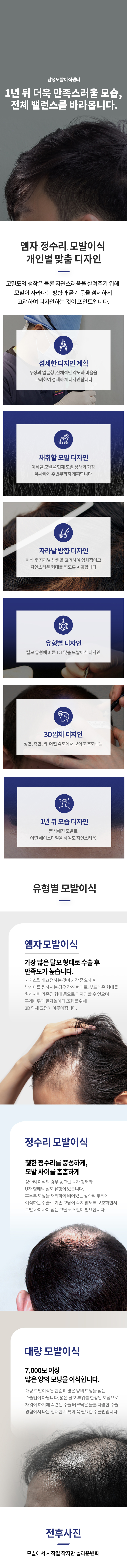 남성 모발이식센터